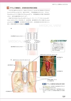 足・足関節の最新の手術 (OS NEXUS(電子版付き) 19) | 中村 茂
